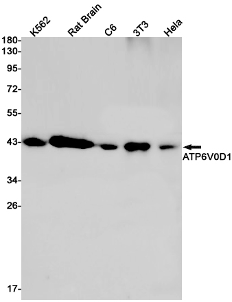 ATP6V0D1 Rabbit mAb