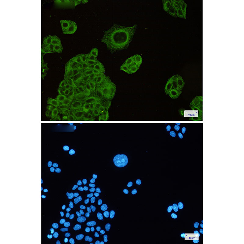 beta IV Tubulin Rabbit mAb