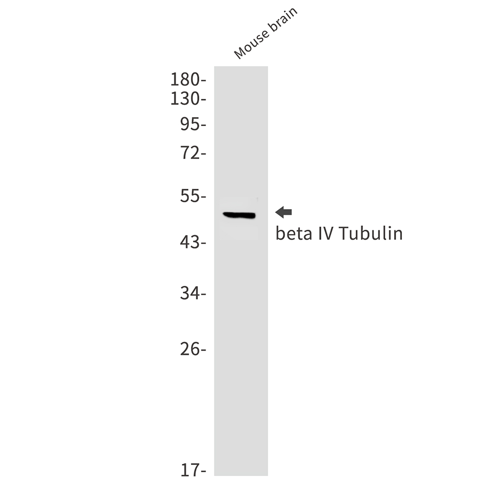 beta IV Tubulin Rabbit mAb