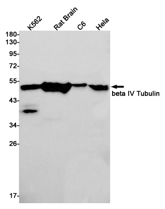 beta IV Tubulin Rabbit mAb