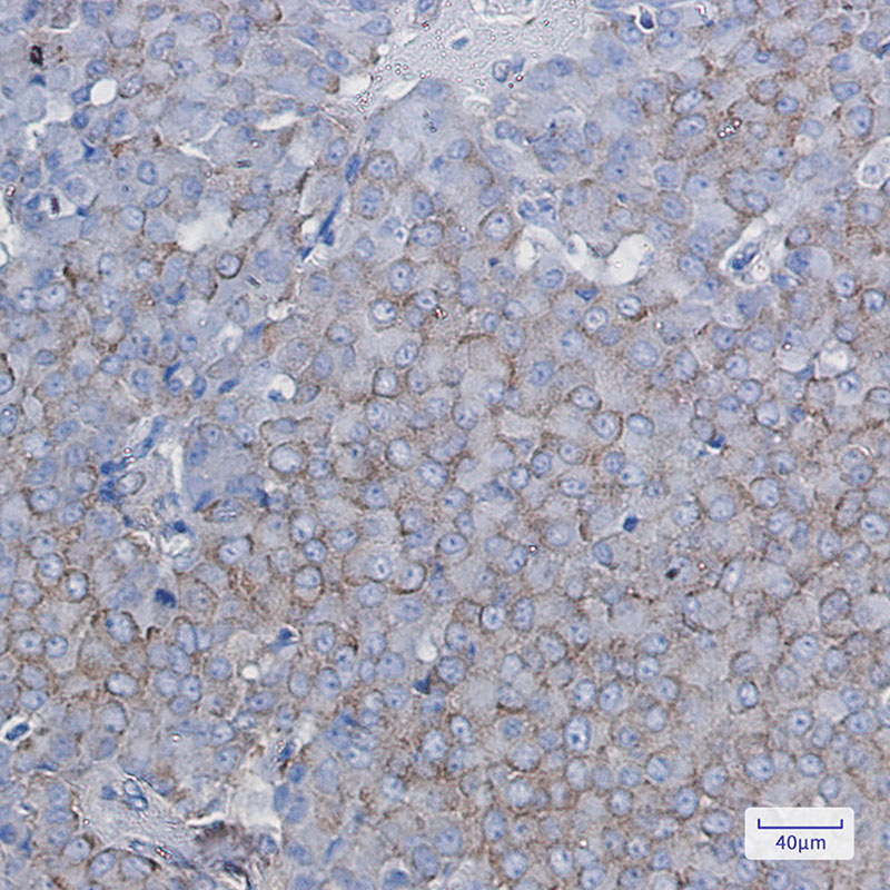 BTF3 Rabbit mAb