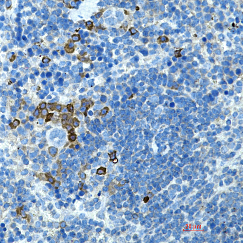 CD272 Rabbit mAb