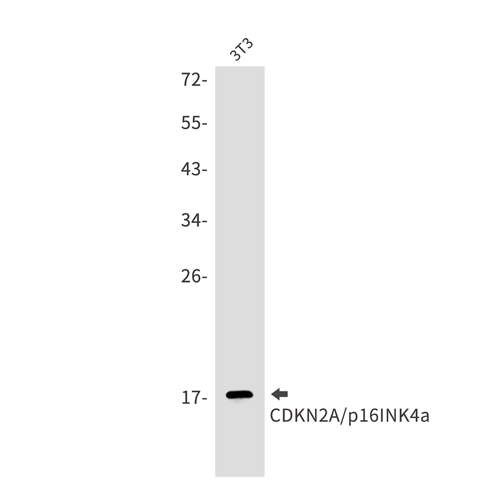 CDKN2A/p16INK4a Rabbit mAb