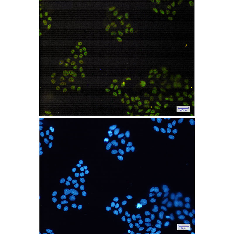 CGBP Rabbit mAb