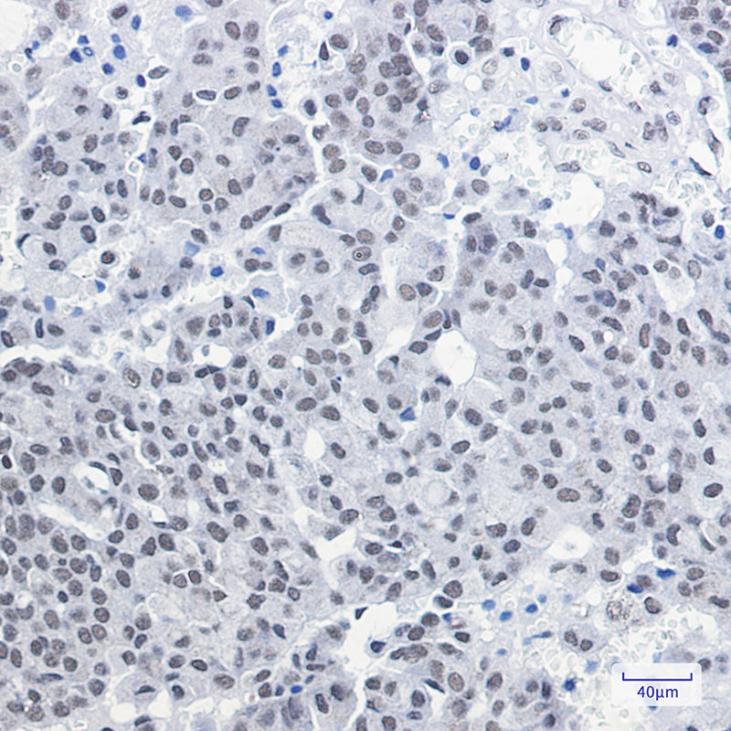 CGBP Rabbit mAb