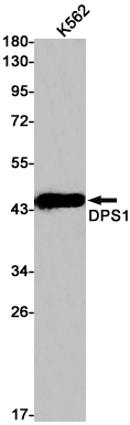 DPS1 Rabbit mAb