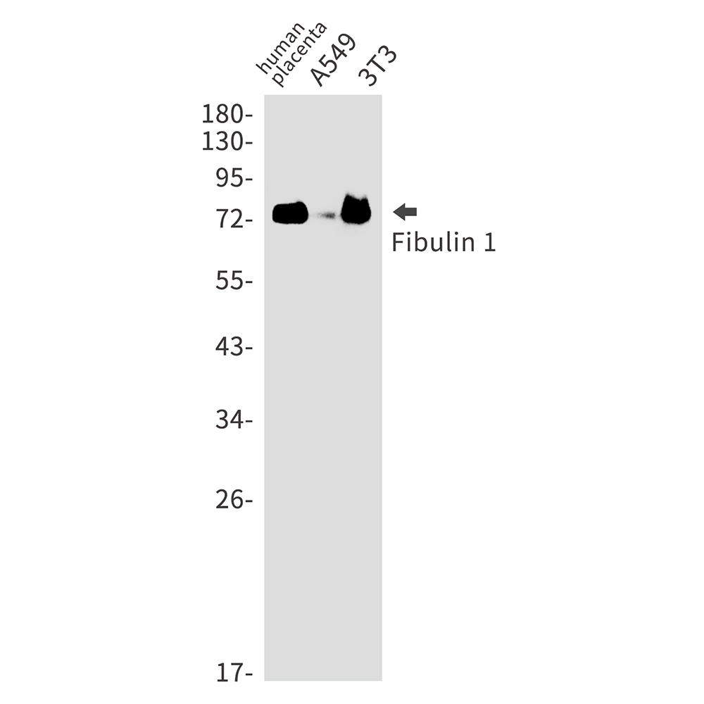 Fibulin 1 Rabbit mAb