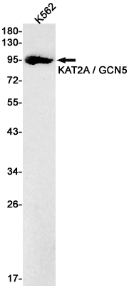 KAT2A Rabbit mAb