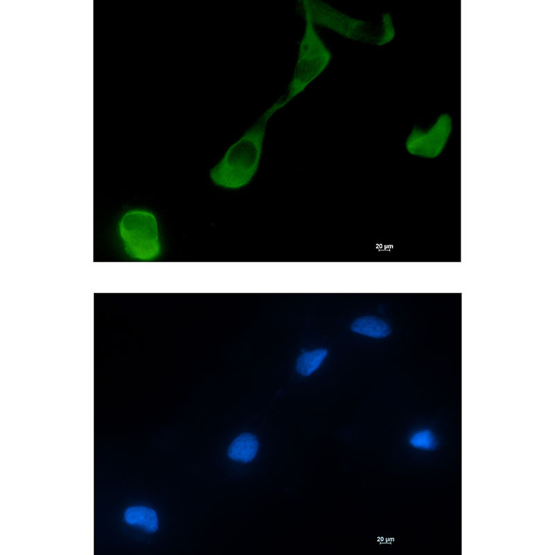 GFPT2 Rabbit mAb