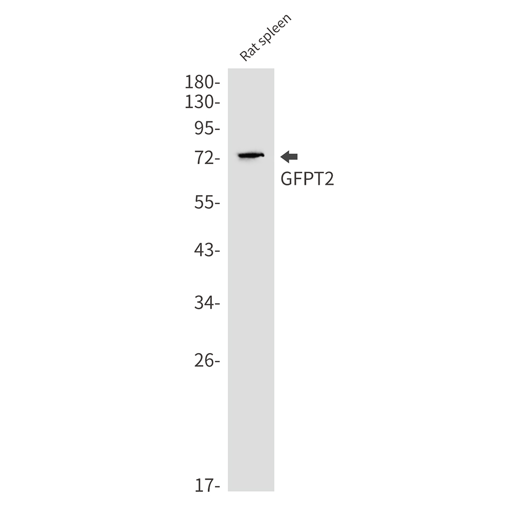 GFPT2 Rabbit mAb