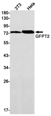 GFPT2 Rabbit mAb