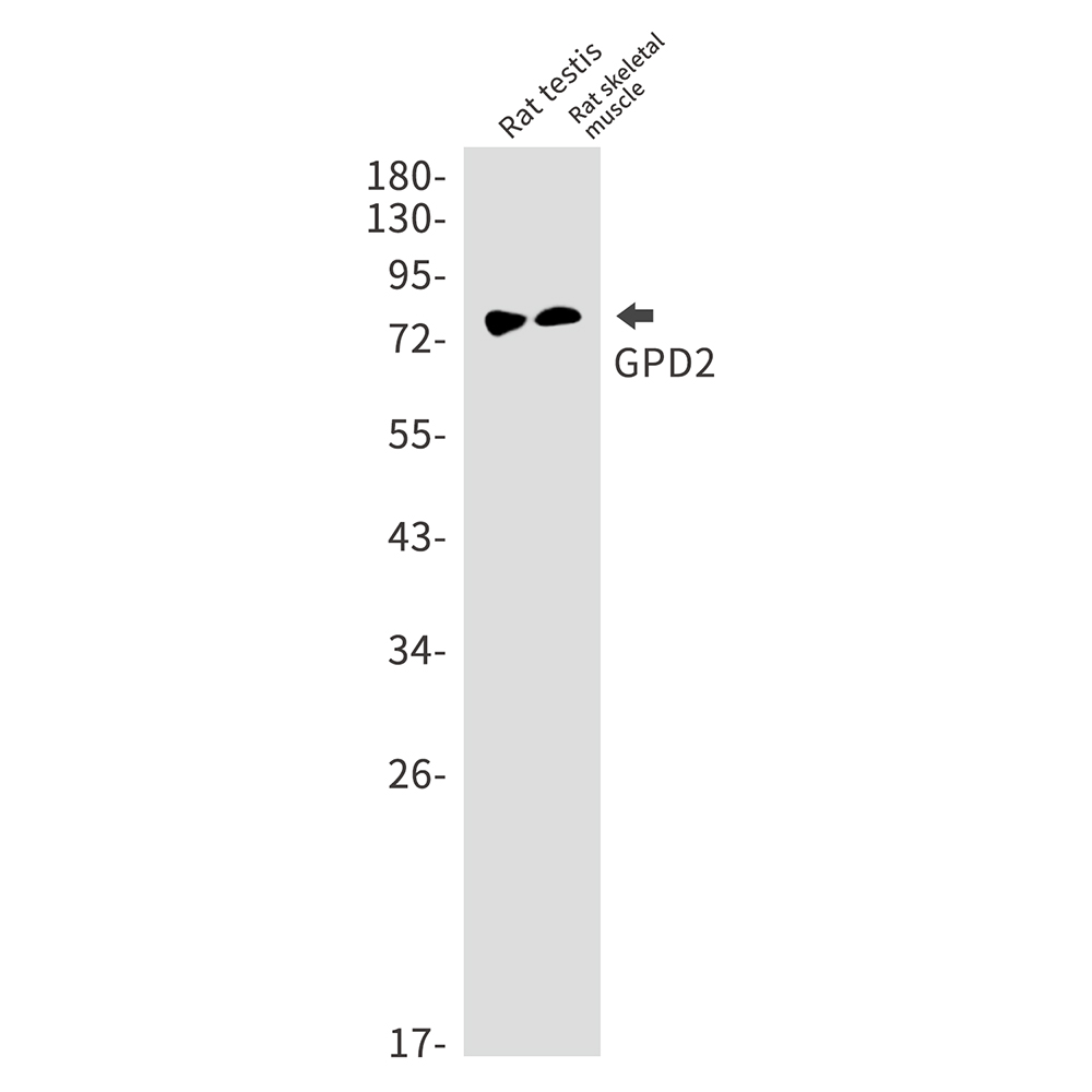 GPD2 Rabbit mAb