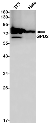 GPD2 Rabbit mAb