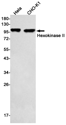 Hexokinase II Rabbit mAb