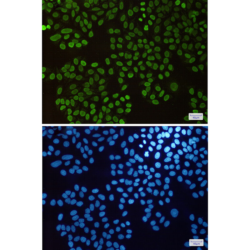 Histone H1.3 Rabbit mAb