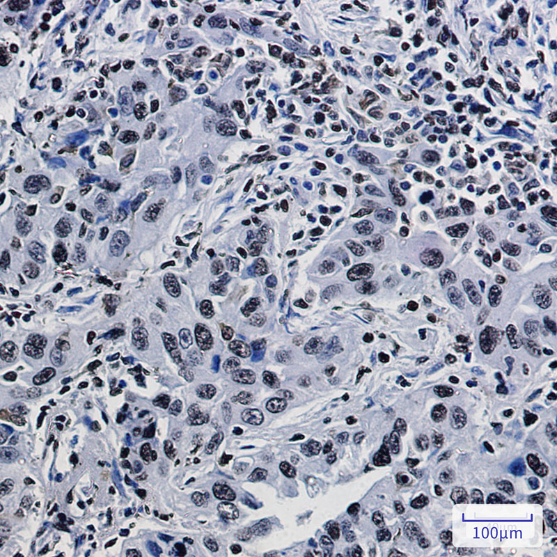 Histone H1.3 Rabbit mAb