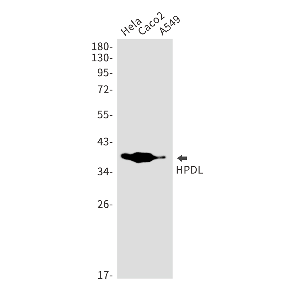 HPDL Rabbit mAb