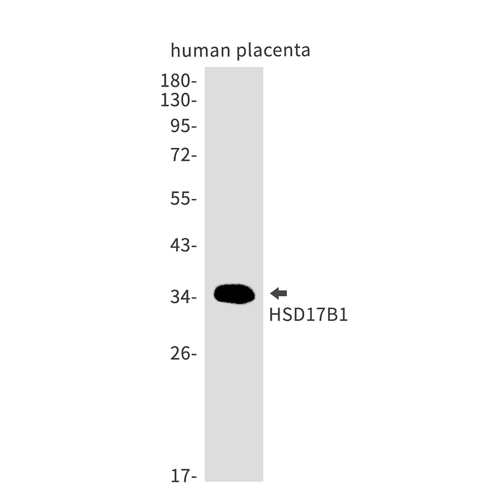 HSD17B1 Rabbit mAb