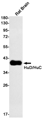 HuC/HuD Rabbit mAb