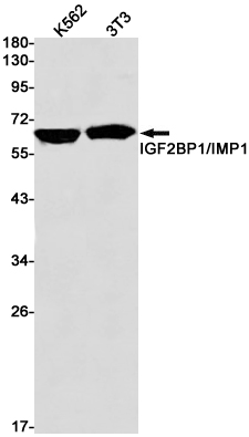 IGF2BP1 Rabbit mAb