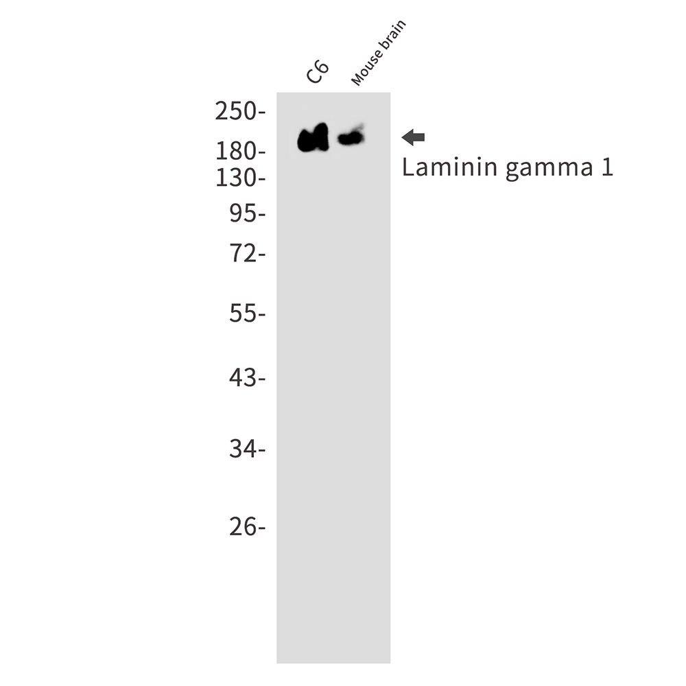 Laminin gamma 1 Rabbit mAb