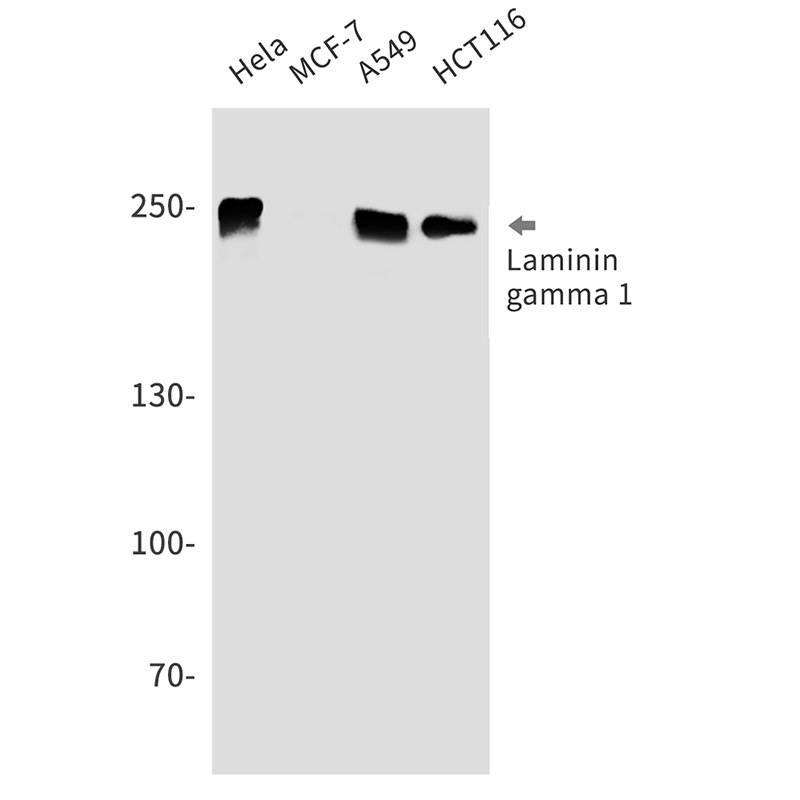 Laminin gamma 1 Rabbit mAb