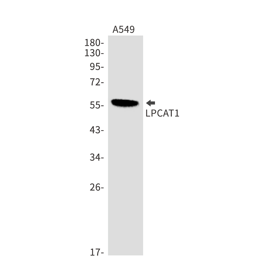 LPCAT1 Rabbit mAb