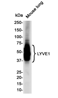 LYVE1 Rabbit mAb