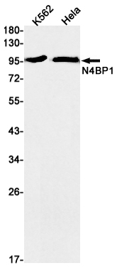 N4BP1 Rabbit mAb