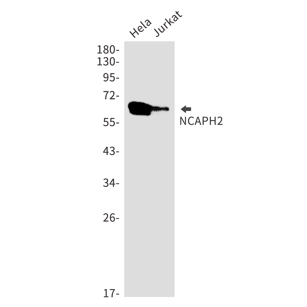 NCAPH2 Rabbit mAb