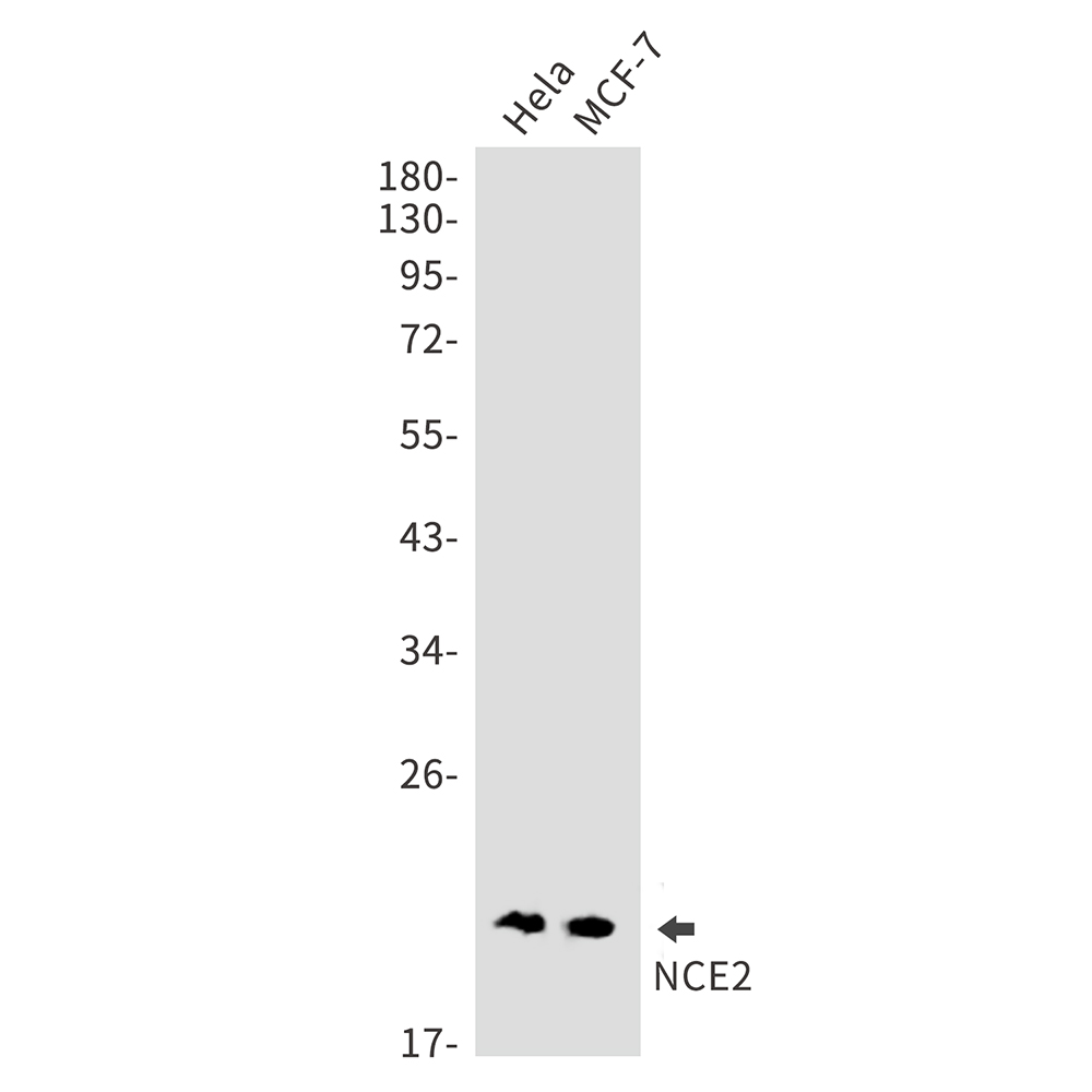 NCE2 Rabbit mAb