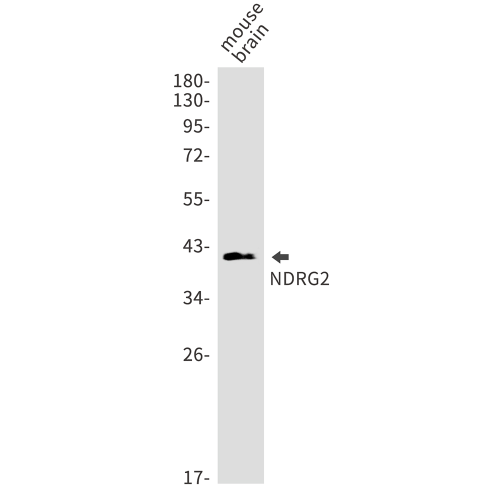 NDRG2 Rabbit mAb