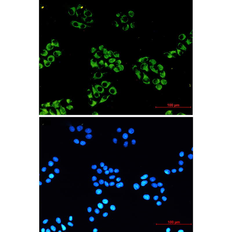 NDUFB10 Rabbit mAb