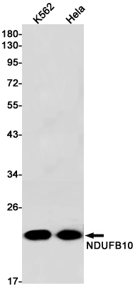 NDUFB10 Rabbit mAb