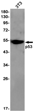 p53 Rabbit mAb