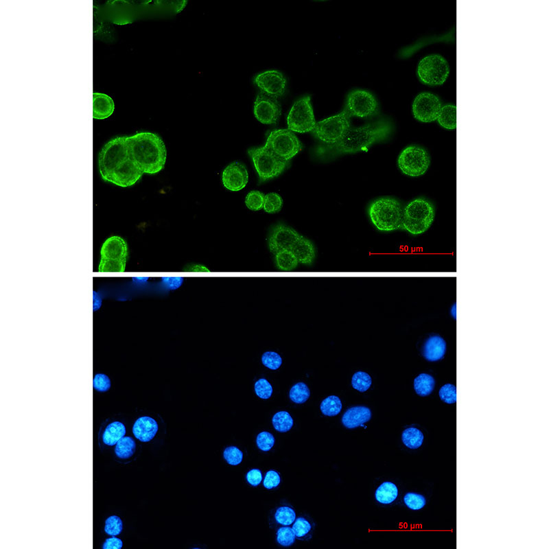 Cadherin Rabbit mAb