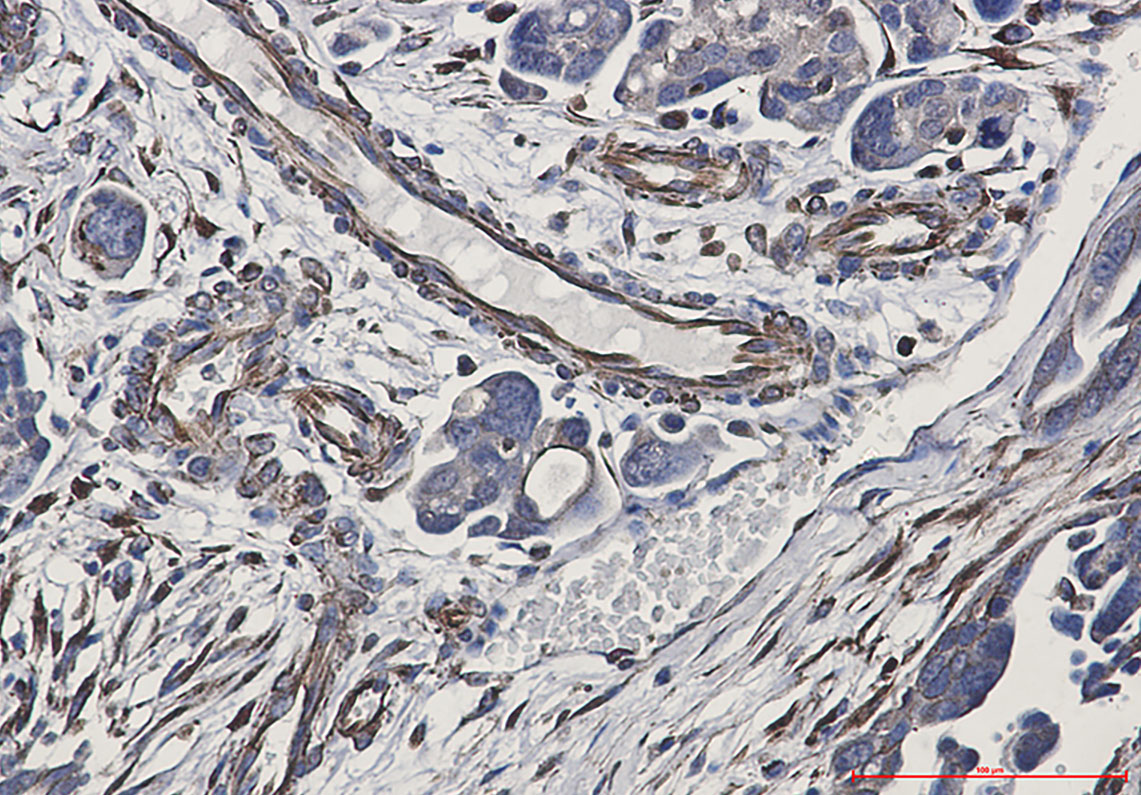 Cadherin Rabbit mAb