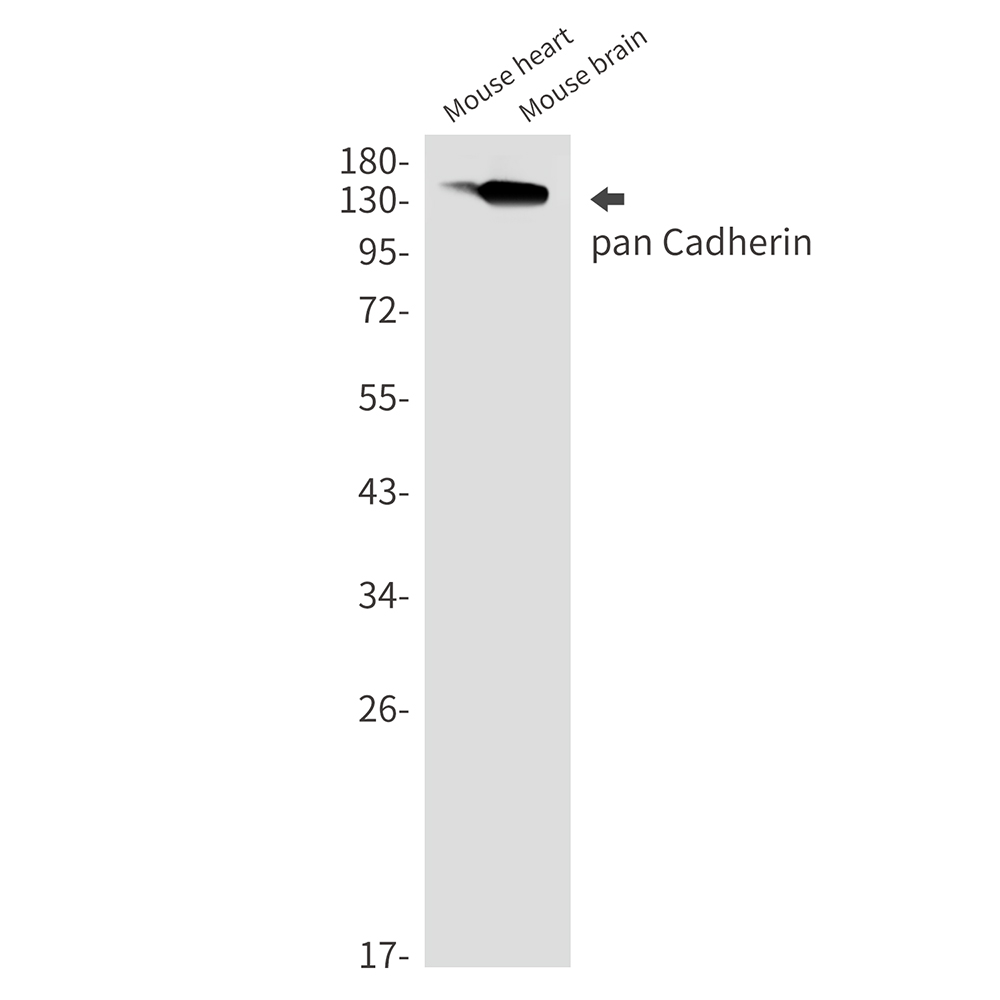 Cadherin Rabbit mAb