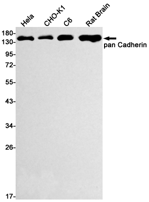 Cadherin Rabbit mAb