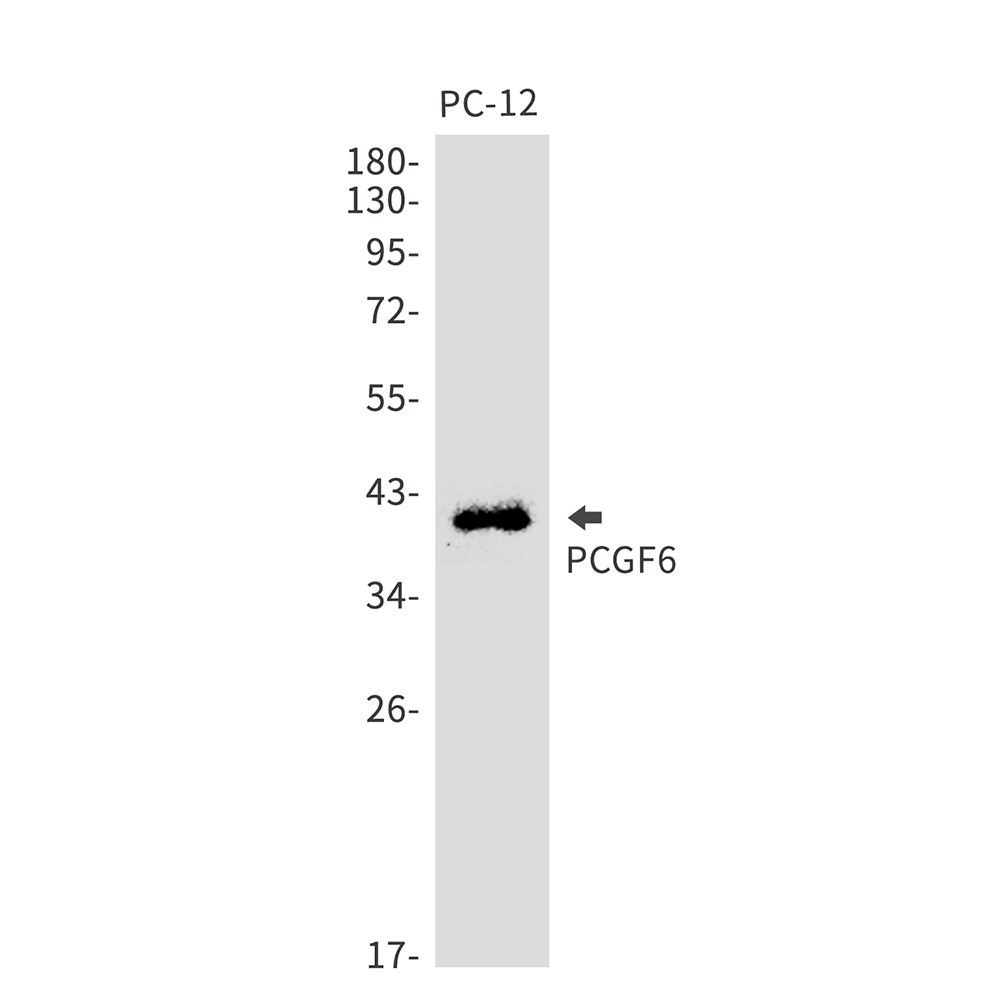 PCGF6 Rabbit mAb