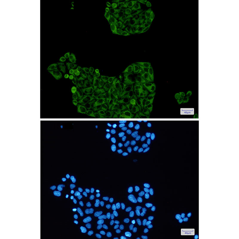 PFKP Rabbit mAb