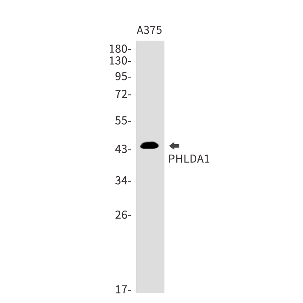 PHLDA1 Rabbit mAb