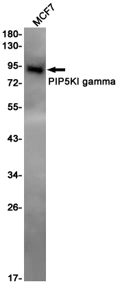 PIP5K1C Rabbit mAb