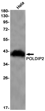 POLDIP2 Rabbit mAb