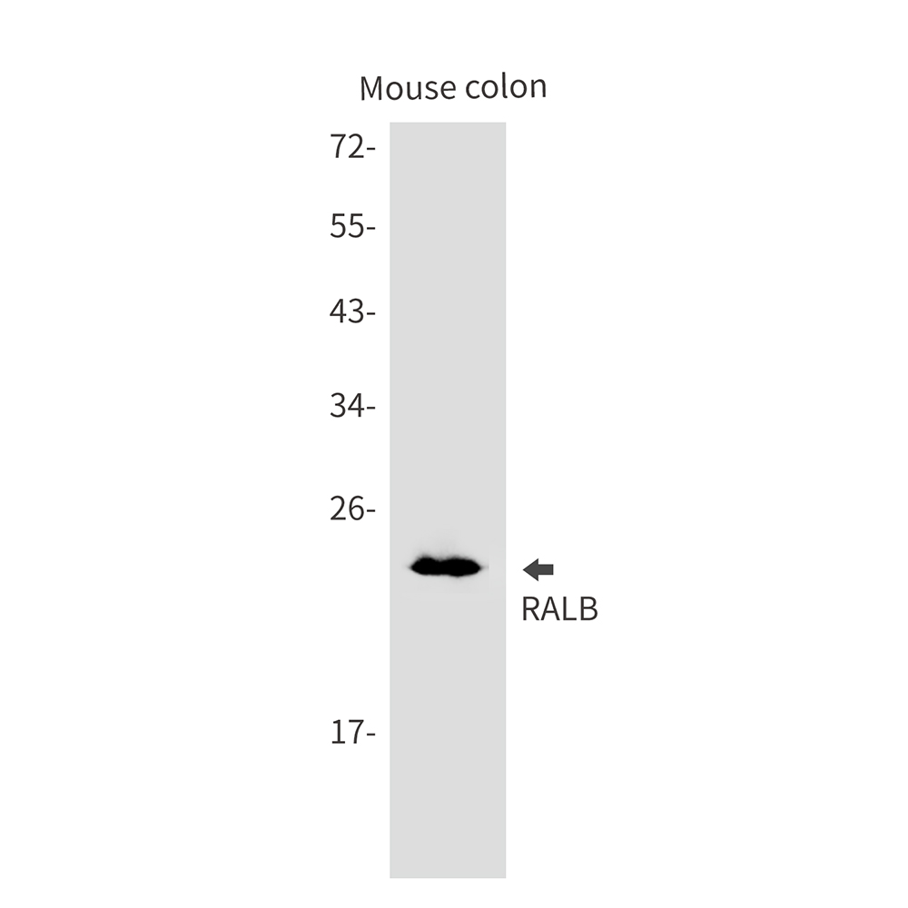 RALB Rabbit mAb