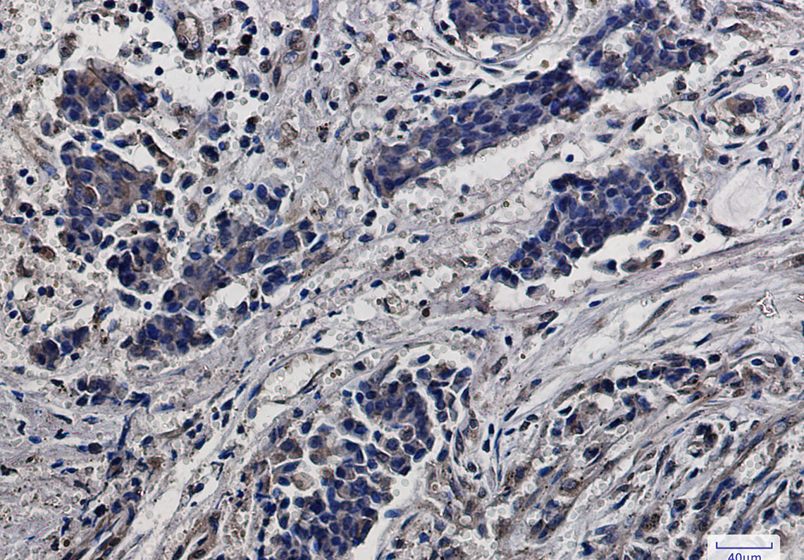 RPS6 Rabbit mAb