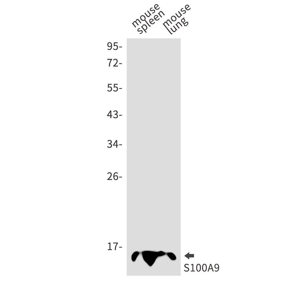 S100 alpha9 Rabbit mAb