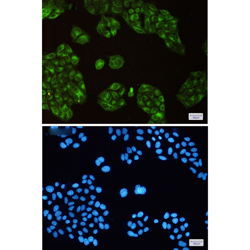 SCD1 Rabbit mAb