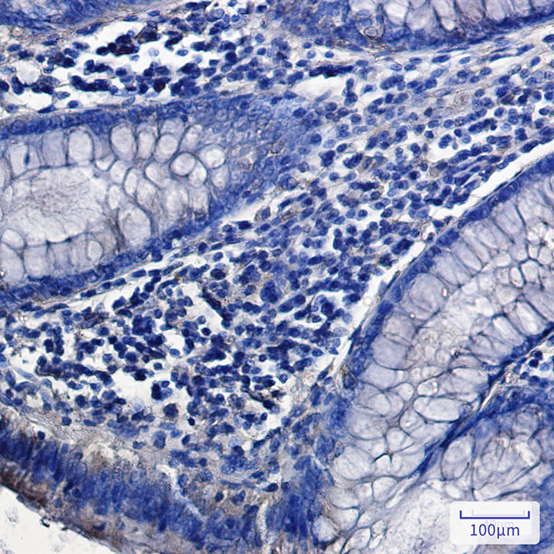 SNX9 Rabbit mAb