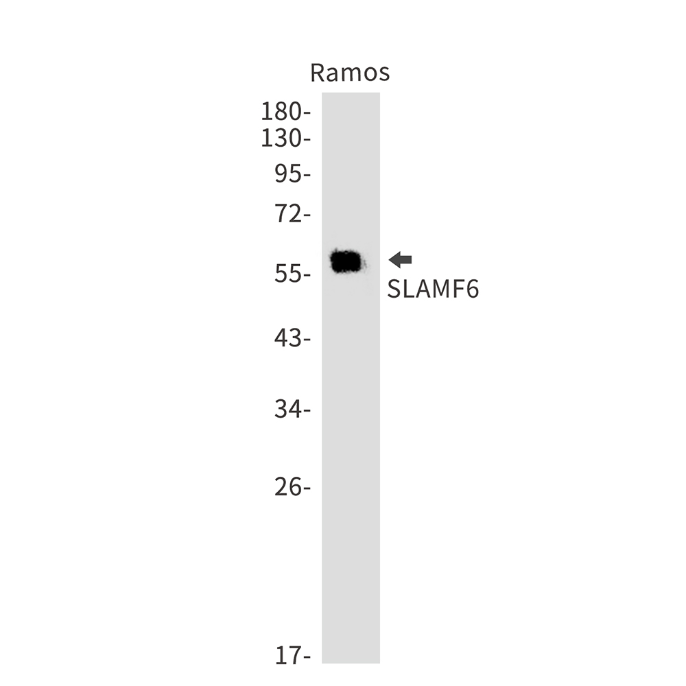 SLAMF6 Rabbit mAb